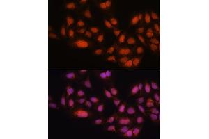 Immunofluorescence (IF) image for anti-MAD2 Mitotic Arrest Deficient-Like 2 (MAD2L2) (AA 1-211) antibody (ABIN6143422)