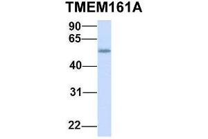 Host:  Rabbit  Target Name:  TMEM161A  Sample Type:  Human Fetal Heart  Antibody Dilution:  1. (TMEM161A 抗体  (Middle Region))