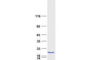 Western Blotting (WB) image for Family with Sequence Similarity 32, Member A (FAM32A) protein (Myc-DYKDDDDK Tag) (ABIN2720777)