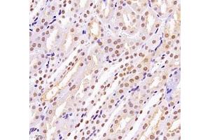 Immunohistochemistry of paraffin embedded mouse kidney using MECOM (ABIN7074575) at dilution of 1: 2200 (400x lens) (MECOM 抗体)