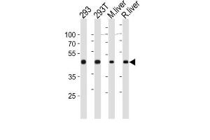 Western Blotting (WB) image for anti-Ornithine Aminotransferase (OAT) antibody (ABIN3003953) (OAT 抗体)