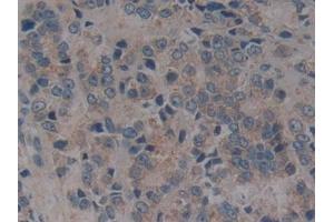 Immunohistochemistry (IHC) image for anti-CD40 (CD40) (AA 26-187) antibody (ABIN7442747)