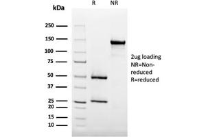SDS-PAGE Analysis Purified CD35 Mouse Monoclonal Antibody (SPM554). (CD35 抗体)