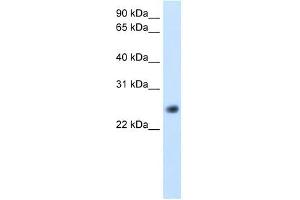 GGTLA4 antibody used at 5 ug/ml to detect target protein.
