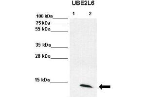 WB Suggested Anti-UBE2L6 Antibody  Positive Control: Lane1: 70ug U6A lysate, Lane, 2: 70ug IFN-g stimulated U6A lysate  Primary Antibody Dilution :  1:2000 Secondary Antibody :  Anti-rabbit-HRP  Secondry Antibody Dilution :  1:5000 Submitted by: Torsten Ginter & Dr. (UBE2L6 抗体  (Middle Region))