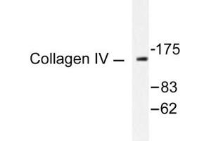 Image no. 1 for anti-Collagen, Type IV (COL4) antibody (ABIN265367) (Collagen IV 抗体)