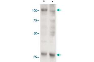 Cell line 143B overexpressing human AARS2 and probed with AARS2 polyclonal antibody  (mock transfection in second lane). (AARS2 抗体  (AA 478-489))