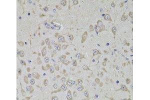 Immunohistochemistry of paraffin-embedded Mouse brain using RPL3 Polyclonal Antibody at dilution of 1:100 (40x lens). (RPL3 抗体)