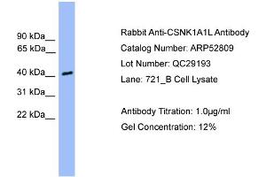 WB Suggested Anti-CSNK1A1L  Antibody Titration: 0. (CSNK1A1L 抗体  (Middle Region))