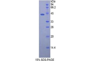 SDS-PAGE analysis of Rat CAMP Protein. (Cathelicidin Antimicrobial Peptide (CAMP) Peptide)