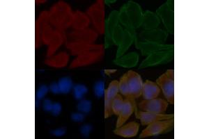 ABIN6258625 and ABIN6275893 staining Hela cells(30 min of UV treatment) by IF/ICC. (CPA1 抗体  (Internal Region))