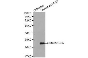 Western blot analysis of extracts from HeLa cells using Phospho-BCL2L1-S62 antibody (ABIN2987905). (BCL2L1 抗体  (pSer62))