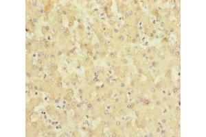 Immunohistochemistry of paraffin-embedded human liver tissue using ABIN7169946 at dilution of 1:100 (SLC6A12 抗体  (AA 515-614))