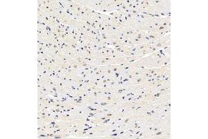 Immunohistochemistry of paraffin embedded mouse heart using HDAC (ABIN7074234) at dilution of 1:1200 (300x lens) (HDAC11 抗体)