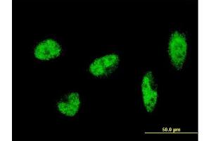 Immunofluorescence of monoclonal antibody to SH2B1 on HeLa cell. (SH2B1 抗体  (AA 327-426))
