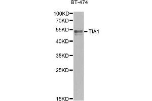 Western blot analysis of extracts of BT-474 cells, using TIA1 antibody. (TIA1 抗体)