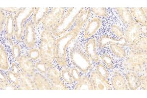 Immunohistochemistry (IHC) image for anti-HLA Class I Histocompatibility Antigen, alpha Chain E (HLA-E) (AA 22-358) antibody (ABIN7434017)