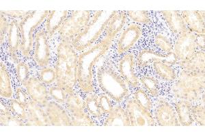 Detection of MHCE in Human Kidney Tissue using Polyclonal Antibody to Major Histocompatibility Complex Class I E (MHCE)