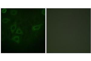 Immunofluorescence analysis of HepG2 cells, using TK (epitope around residue 13) antibody. (TK (N-Term), (Ser13) 抗体)