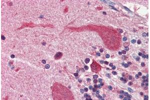 Human Brain, Cerebellum (formalin-fixed, paraffin-embedded) stained with Heat Shock Protein 90 (HSP90) antibody ABIN364328 at 5 ug/ml followed by biotinylated anti-mouse IgG secondary antibody ABIN481714, alkaline phosphatase-streptavidin and chromogen. (HSP90 抗体  (AA 1-732))