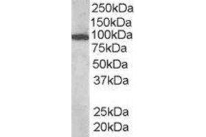 ABIN2560712 (1µg/ml) staining of human bone marrow lysate (35µg protein in RIPA buffer). (VAV3 抗体  (Internal Region))
