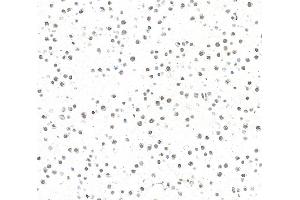 Immunocytochemistry (ICC) image for anti-AT Rich Interactive Domain 1B (SWI1-Like) (ARID1B) (AA 1425-1475) antibody (ABIN7795694) (Recombinant ARID1B 抗体  (AA 1425-1475))