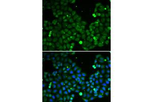 Immunofluorescence analysis of A549 cells using HIF1AN antibody (ABIN5973179). (HIF1AN 抗体)