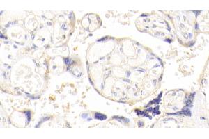 Detection of AKAP12 in Human Placenta Tissue using Polyclonal Antibody to A Kinase Anchor Protein 12 (AKAP12) (AKAP12 抗体  (AA 1485-1782))