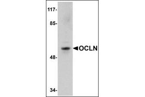 Western blot analysis of OCLN in human liver tissue lysate with this product at 1 μg/ml. (Occludin 抗体  (C-Term))