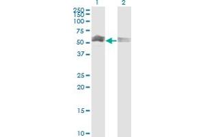 Western Blot analysis of CFLAR expression in transfected 293T cell line by CFLAR monoclonal antibody (M03), clone 1G1. (FLIP 抗体  (AA 178-277))