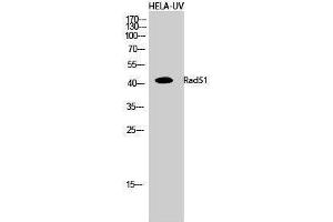 Western Blotting (WB) image for anti-DNA Repair Protein Homolog 1 (RAD51) (Thr555) antibody (ABIN3186658) (RAD51 抗体  (Thr555))