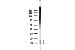 anti-Heat Shock 27kDa Protein Family, Member 7 (Cardiovascular) (HSPB7) (C-Term) antibody