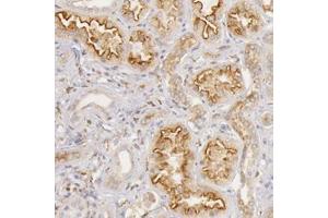 Immunohistochemical staining of human kidney with STX7 polyclonal antibody  shows strong luminal membranous and cytoplasmic positivity in cells in tubules at 1:50-1:200 dilution. (Syntaxin 7 抗体)