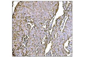 IHC analysis of HCCS using anti-HCCS antibody (ABIN7602424).