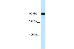 Western Blotting (WB) image for anti-Class II, Major Histocompatibility Complex, Transactivator (CIITA) (C-Term) antibody (ABIN927649)