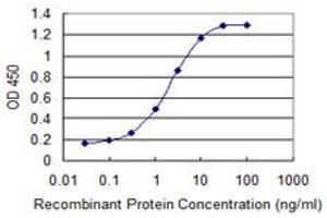 Detection limit for recombinant GST tagged SKIL is 0. (SKIL 抗体  (AA 236-313))