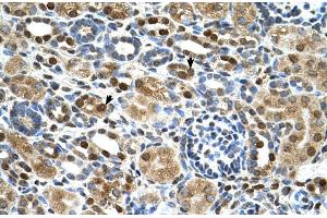 Human kidney (ZNF169 抗体  (Middle Region))