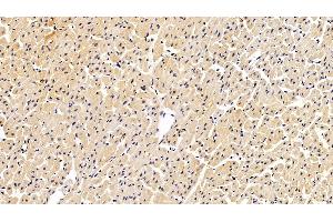 Detection of S100A6 in Porcine Cardiac Muscle Tissue using Polyclonal Antibody to S100 Calcium Binding Protein A6 (S100A6)