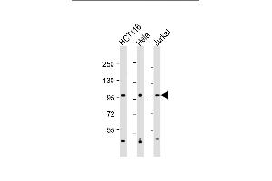 All lanes : Anti-NBA Antibody (C-Term) at 1:2000 dilution Lane 1: HC whole cell lysate Lane 2: Hela whole cell lysate Lane 3: Jurkat whole cell lysate Lysates/proteins at 20 μg per lane. (MANBA 抗体  (AA 712-745))