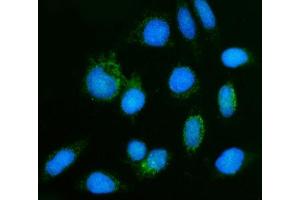 IF analysis of GHITM using anti-GHITM antibody (ABIN7599294).