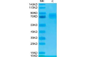 SDS-PAGE (SDS) image for Tumor-Associated Calcium Signal Transducer 2 (TACSTD2) (AA 27-274) protein (Fc Tag) (ABIN7275795)