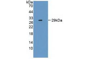 Western blot analysis of recombinant Human IL2Ra. (CD25 抗体  (AA 22-213))