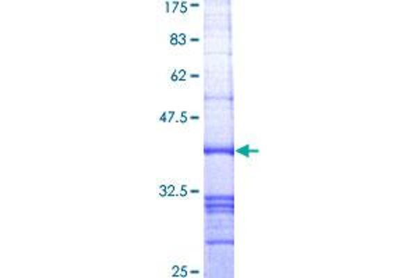 MIB2 Protein (AA 381-480) (GST tag)