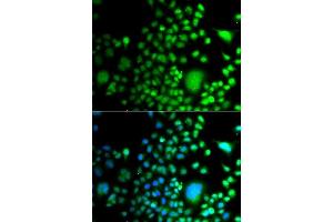 Immunofluorescence analysis of A549 cells using PAX6 antibody. (PAX6 抗体  (AA 1-300))