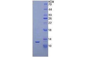 SDS-PAGE analysis of Human NT-ProBNP Protein. (Pro-Brain Natriuretic Peptide (NT-ProBNP) (NT-ProBNP) (N-Term) Peptide)