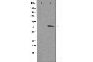 Western blot analysis of extracts from Jurkat cells, using Cytochrome P450 3A43 antibody. (CYP3A4 抗体  (Internal Region))