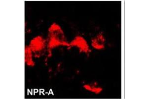 Image no. 1 for anti-Natriuretic Peptide Receptor A/guanylate Cyclase A (Atrionatriuretic Peptide Receptor A) (NPR1) (N-Term) antibody (ABIN360587) (NPR1 抗体  (N-Term))