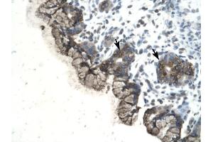 PARP3 antibody was used for immunohistochemistry at a concentration of 4-8 ug/ml to stain Epithelial cells of fundic glands (arrows) in Human Stomach. (PARP3 抗体)