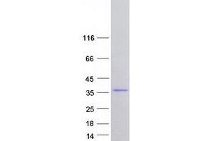 Western Blotting (WB) image for Family with Sequence Similarity 76, Member A (FAM76A) (Transcript Variant 4) protein (Myc-DYKDDDDK Tag) (ABIN2720806)