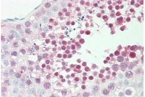Human Testis: Formalin-Fixed, Paraffin-Embedded (FFPE) (GLRX3 抗体  (AA 81-110))